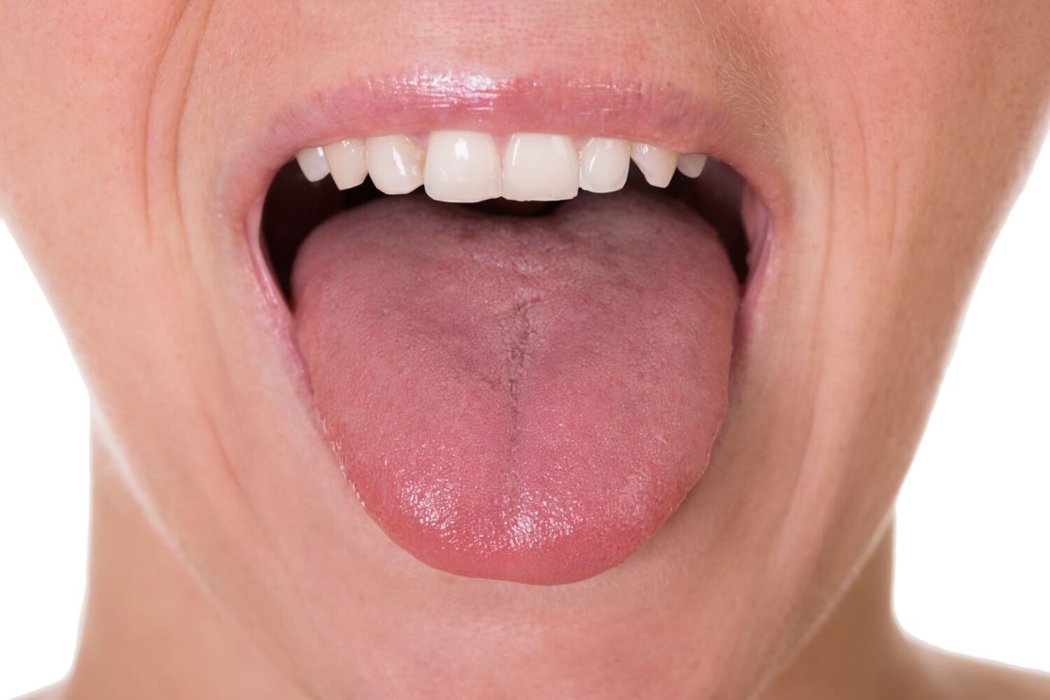 The Tongue Tells All: 4 Signs of Poor Oral Hygiene