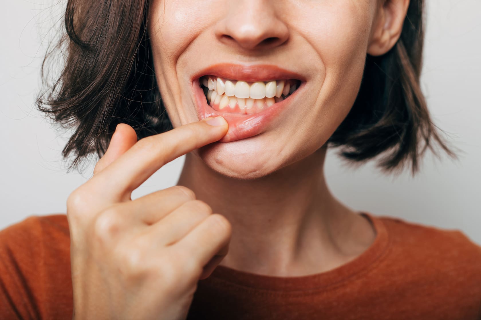 Four Signs of Gum Disease